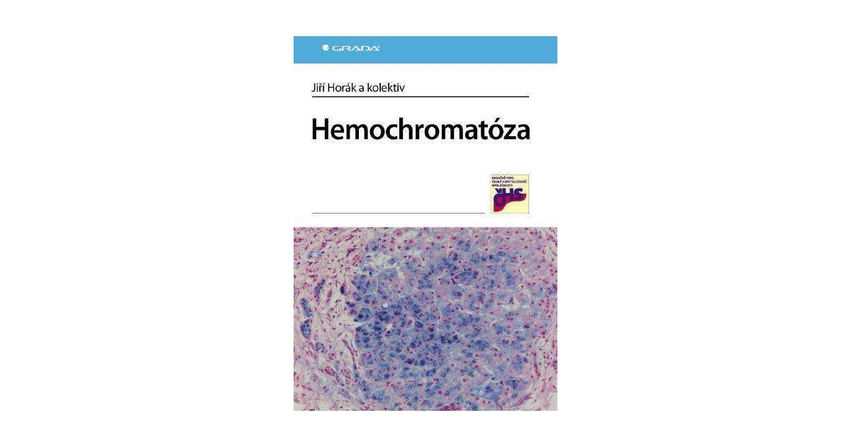 Hemochromatóza eKnihy elektronické knihy vaše eKNIHOVNA cz