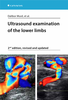 Ultrasound examination of the lower limbs