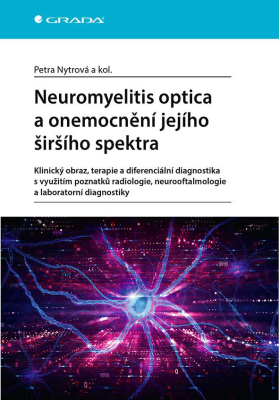 Neuromyelitis optica a poruchy jejího širšího spektra