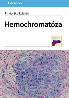Hemochromatóza